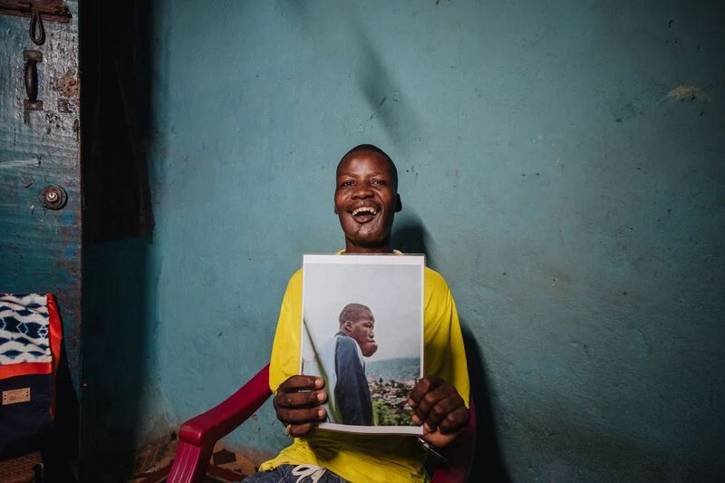 Mercy Ships removed tumor